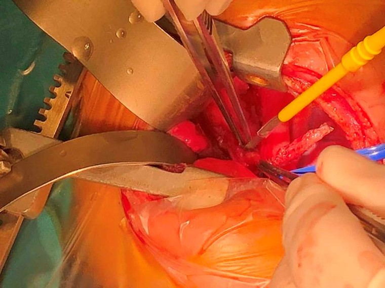 Bé sơ sinh thoát khỏi căn bệnh hiếm chỉ 40 người trên thế giới mắc phải ảnh 1