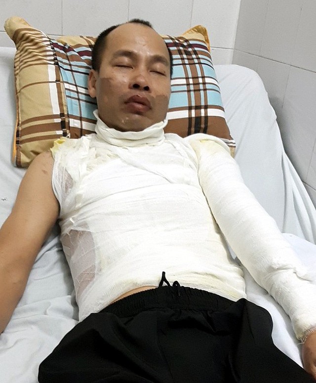 Bé gái hoảng loạn chứng kiến bố đau đớn khi bị tạt axit ảnh 1