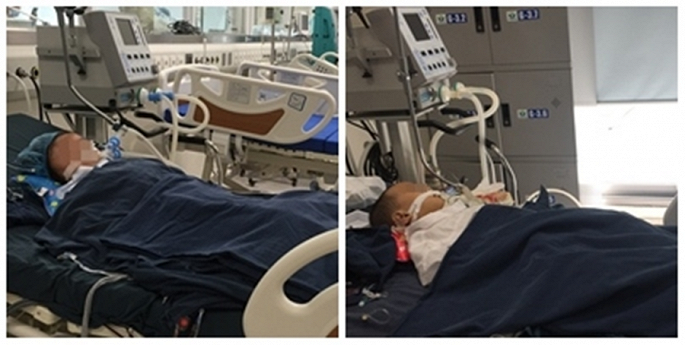 Thêm 3 trẻ đang nguy kịch, suy đa tạng vì ong đốt ảnh 1