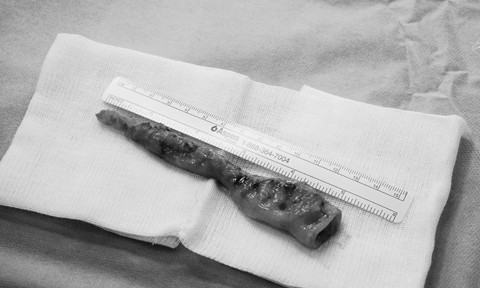 Bệnh viện hỗ trợ chi phí cứu bé trai bị mắc nhiều bệnh bẩm sinh ảnh 1