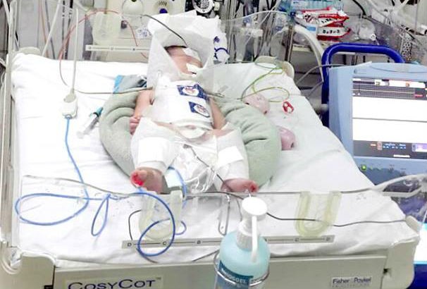 Mẹ vỡ gan lúc chuyển dạ, bé sơ sinh sống sót thần kỳ ảnh 2