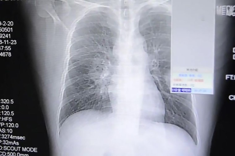 Nhập viện vì thói quen... ngửi vớ thối mỗi ngày ảnh 1