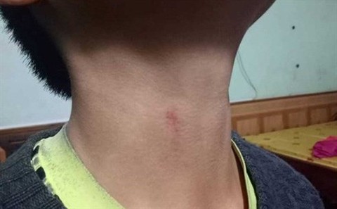 Tố hiệu trưởng bóp cổ học sinh: Chỉ túm cổ áo ảnh 1