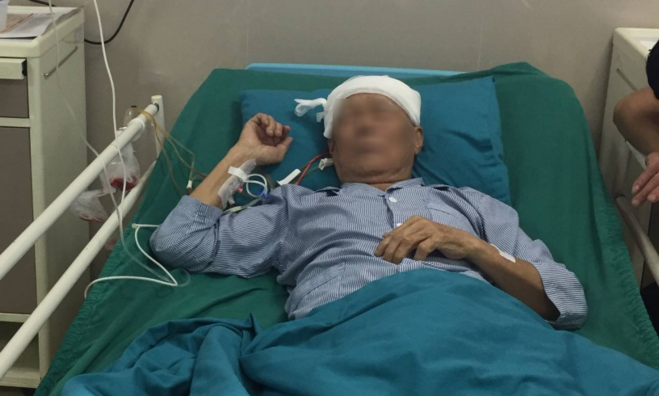 Đang phẫu thuật não, cụ ông vẫn 'tám chuyện' với bác sĩ như thường ảnh 1