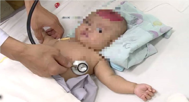 Bé 2 tháng tuổi bị chấn thương sọ não vì điện thoại rơi trúng đầu ảnh 1