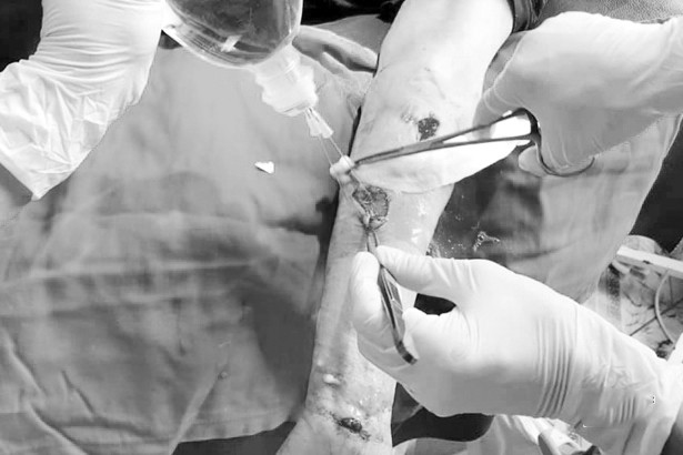 Cụ bà bị chó béc-giê tấn công với hơn 30 vết thương ảnh 1