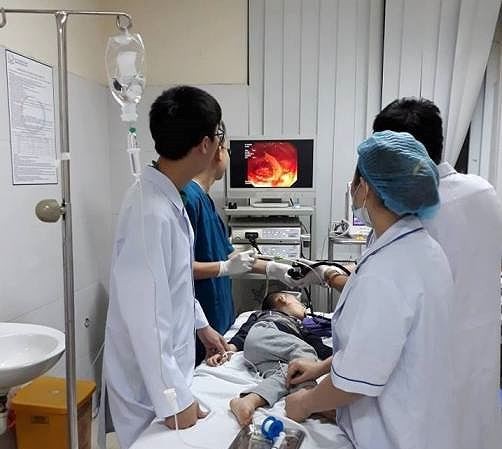 Gắp đinh vít ra khỏi thực quản bệnh nhi 5 tuổi ảnh 1