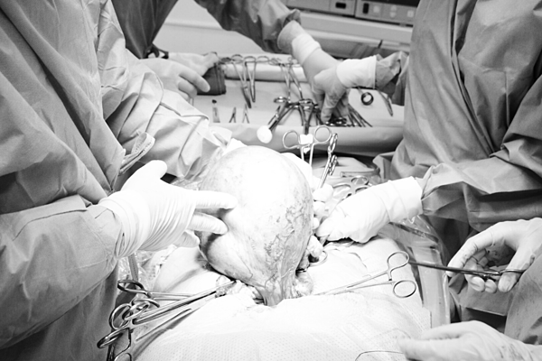 Người phụ nữ mang khối u xơ tử cung nặng 2,5 kg ảnh 1