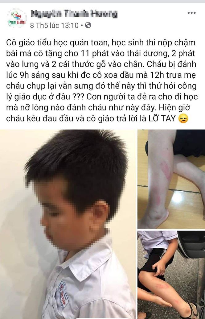 Đình chỉ cô giáo đánh học sinh lớp 2 vì làm bài chậm ảnh 1