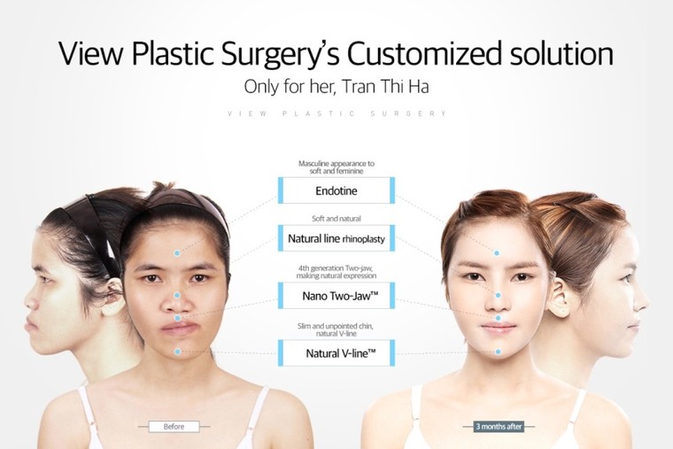 Choáng với tài 'dao kéo' của ê kíp bác sĩ Let Me In vừa sang Việt Nam ảnh 1