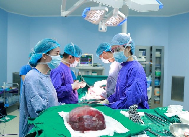 Cắt bỏ khối u máu gan khổng lồ cứu nữ bệnh nhân ảnh 1