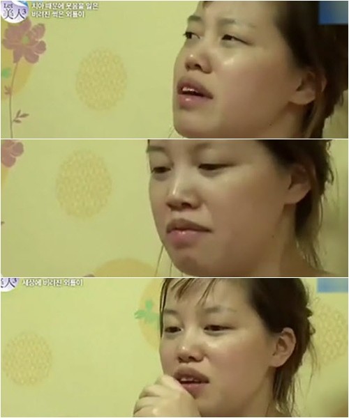 Choáng với tài 'dao kéo' của ê kíp bác sĩ Let Me In vừa sang Việt Nam ảnh 3