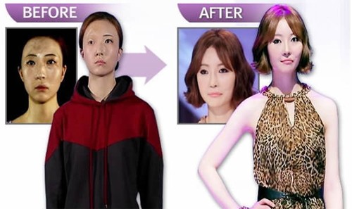 Choáng với tài 'dao kéo' của ê kíp bác sĩ Let Me In vừa sang Việt Nam ảnh 5