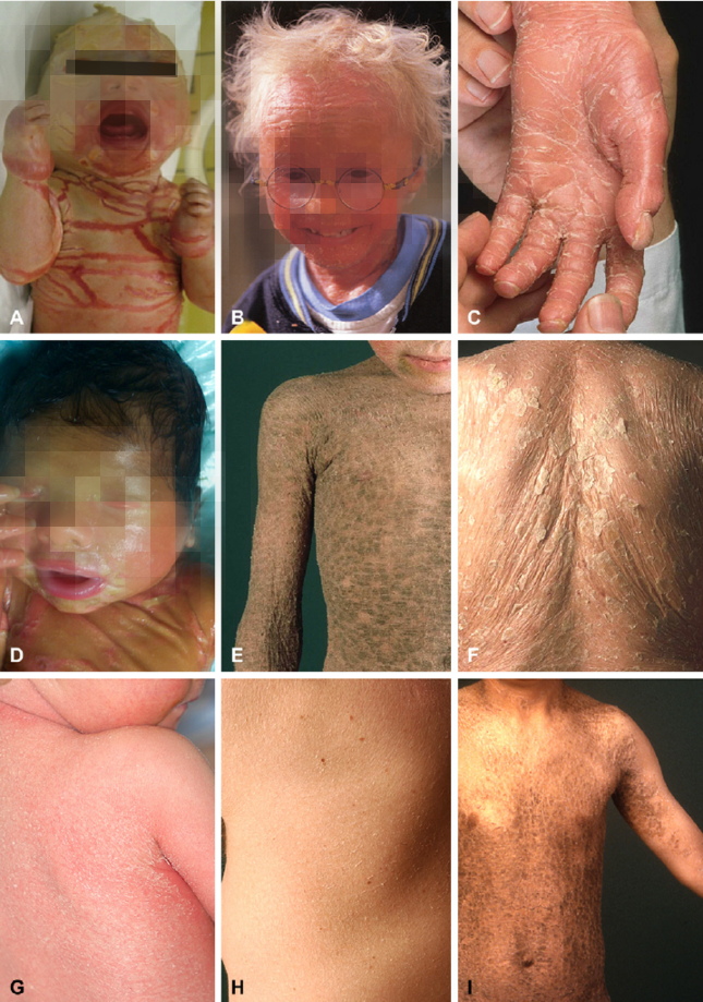 Người mẹ chạy trốn đứa con mới sinh ảnh 1