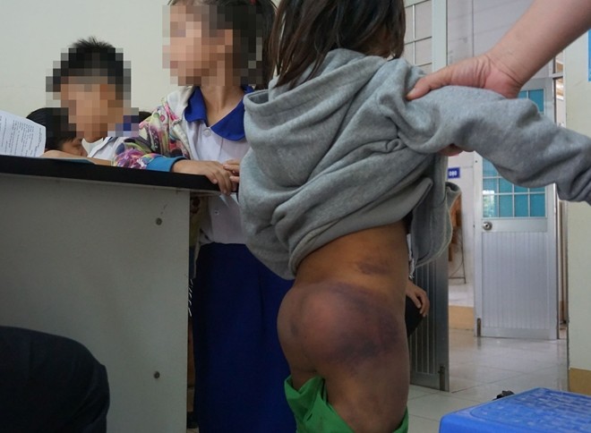 Công an vào cuộc vụ 4 học sinh nghi bị bạo hành ảnh 1