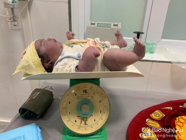 Hy hữu: Trẻ sơ sinh chào đời nặng 5,5kg bằng phương pháp sinh thường ảnh 1