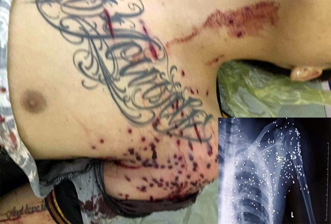 Khởi tố vụ án, khởi tố bị can vụ nổ súng ‘hoa cải’ tại trạm BOT ảnh 1