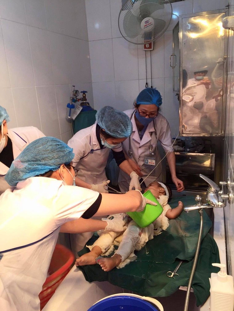 Dùng nước mắm và rượu chữa bỏng, bé trai bị nhiễm trùng nặng ảnh 1