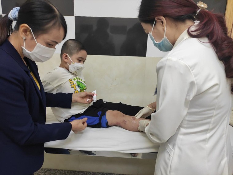 Đề phòng bệnh chốc lây lan ở trẻ trong mùa tựu trường ảnh 1