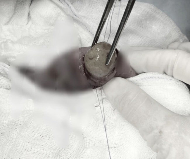 Cảnh báo nguy hiểm khi trẻ nuốt đồ chơi hạt nở ảnh 1