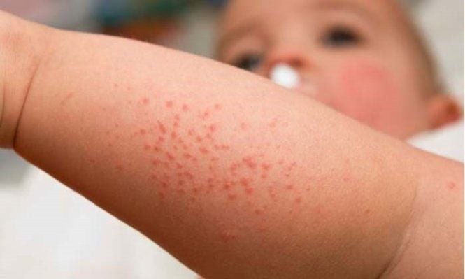Vaccine là “lá chắn” phòng bệnh tốt nhất cho trẻ ảnh 1