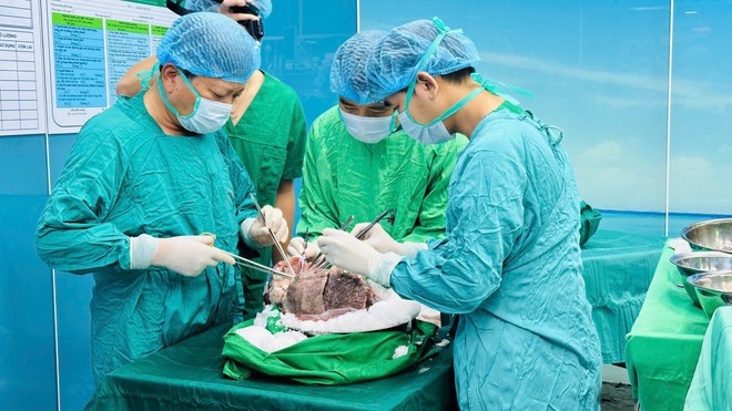 Việt Nam vào danh sách của những Trung tâm ghép phổi lớn trên thế giới ảnh 2