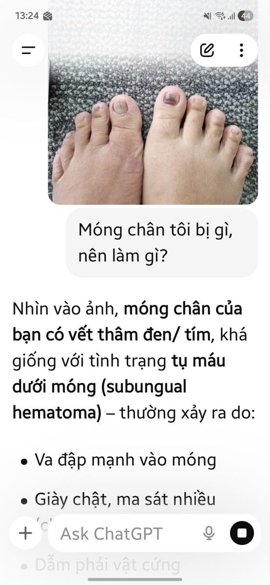 Rủi ro khi tự chẩn đoán bệnh bằng "bác sĩ AI" ảnh 1