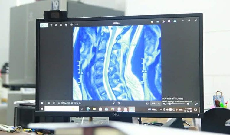 Sử dụng bóng cười liên tục, cô gái 23 tuổi bị liệt yếu tứ chi ảnh 2