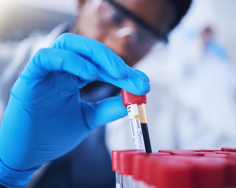 Chỉ cần xét nghiệm máu có thể dự báo sớm bệnh tim di truyền phổ biến nhất thế giới ảnh 1