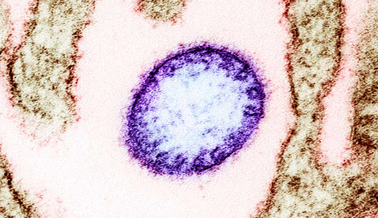 Những rào cản khiến virus Nipah chưa có vaccine ảnh 1