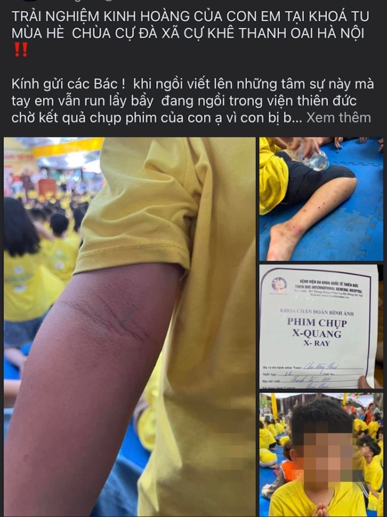 Hà Nội: Yêu cầu tạm dừng các khoá tu mùa hè tại chùa Cự Đà sau vụ trẻ bị đánh phải đi viện ảnh 1