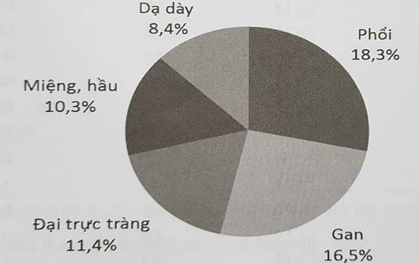 5 loại ung thư thường gặp nhất ở nam giới