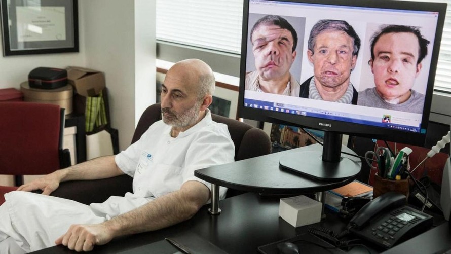 Chuyên gia phẫu thuật thẩm mỹ Laurent Lantieri bên ảnh chụp người đàn ông ba mặt Jérôme Hamon trong văn phòng của ông tại bệnh viện Georges-Pompidou ở Paris, Pháp ngày 13/4. Ảnh: Le Parisien