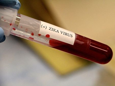 Lạnh dưới 16 độ C, virus Zika sẽ bị tiêu diệt