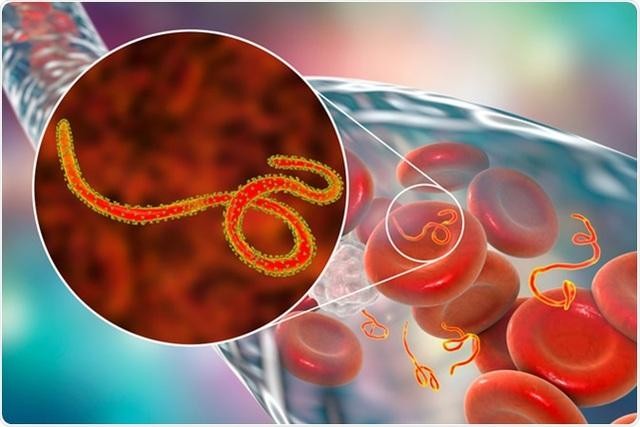 Virus Ebola có thể ẩn náu nhiều năm trong cơ thể người?