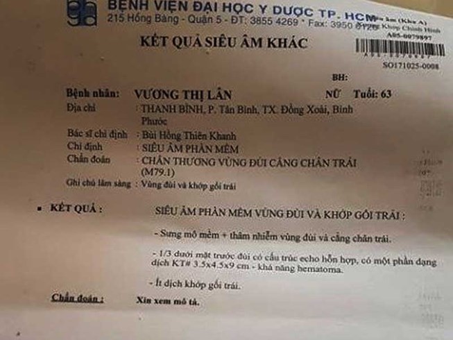 Thẩm phán bị tố đạp vào đùi đương sự