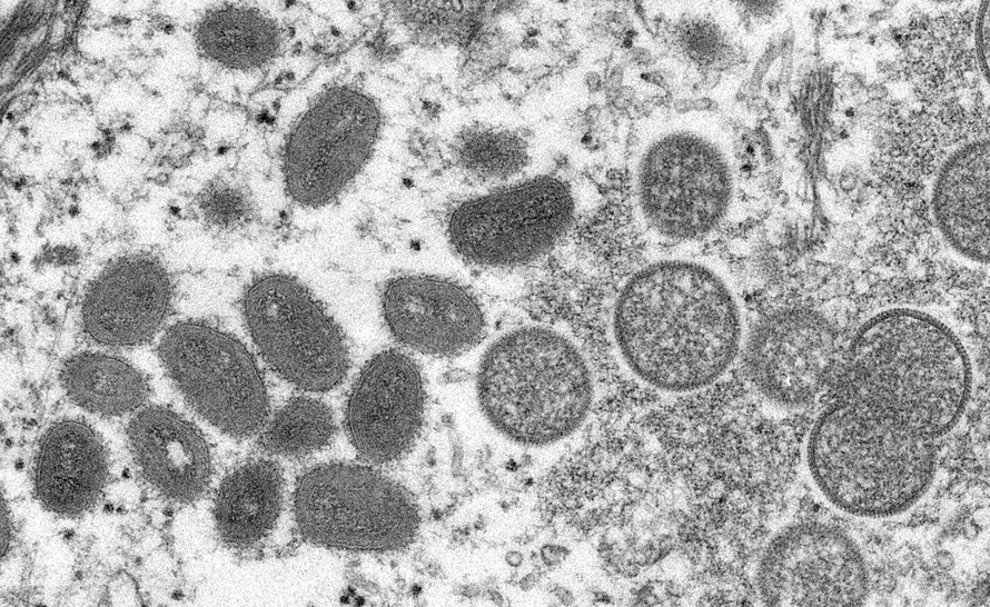 Hình ảnh hiển vi điện tử (EM) cho thấy các hạt virus đậu mùa khỉ thu được từ mẫu da người lâm sàng. Ảnh: Reuters