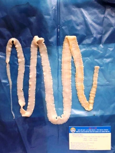 Mẫu sán dây trưởng thành được thu hồi trong cơ thể một bệnh nhân tại Phòng khám bệnh Chuyên khoa Ký sinh trùng, Viện Sốt rét - Ký sinh trùng - Côn trùng TP. HCM.