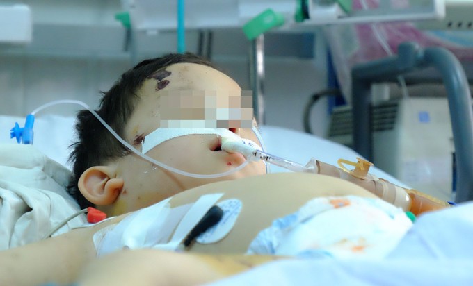 Hiện tại bé trai vẫn đang được tiếp tục chăm sóc trong bệnh viện (Ảnh: Hoàng Lê)