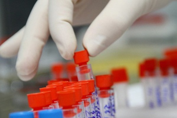 Đường dây nóng cho người tự xét nghiệm HIV