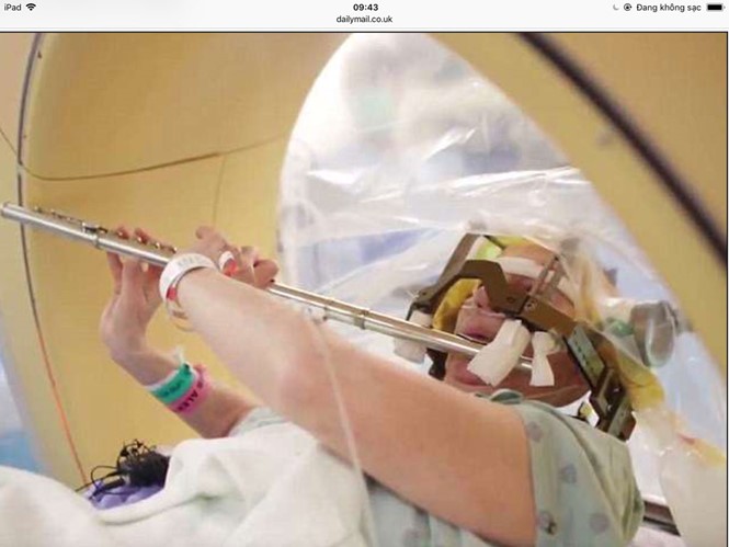 Bà Anna Henry thổi sáo trong khi đang được phẫu thuật kích thích não sâu