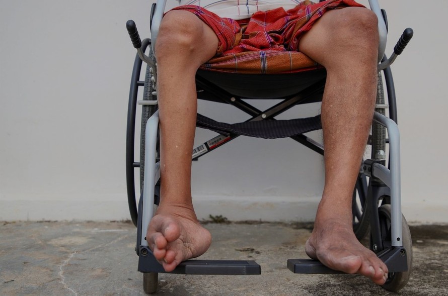 Chủ động ứng phó nguy cơ bệnh bại liệt xâm nhập Việt Nam