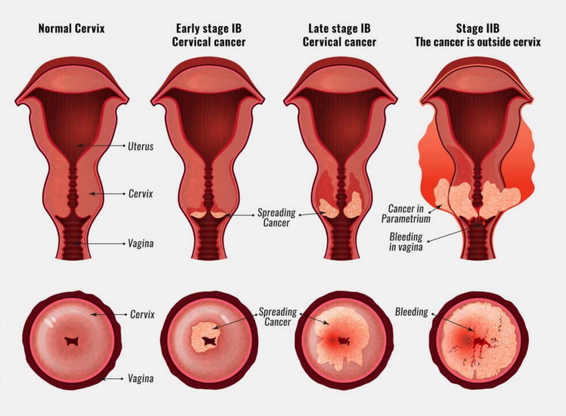 Ảnh minh họa. Nguồn: singingriverhealthsystem