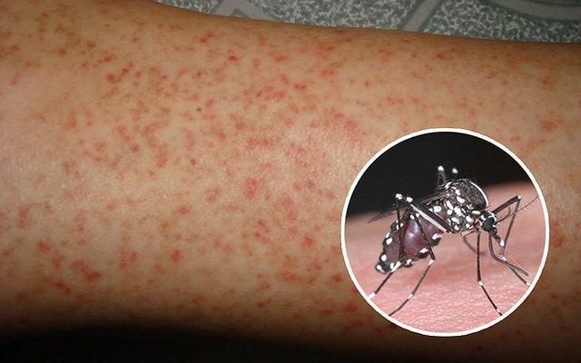 Dự báo gia tăng ca mắc sốt xuất huyết ở Hà Nội