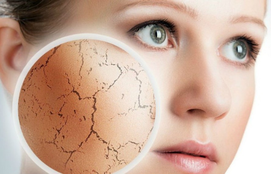 Chuyên gia da liễu chỉ cách chăm sóc da mùa hanh khô