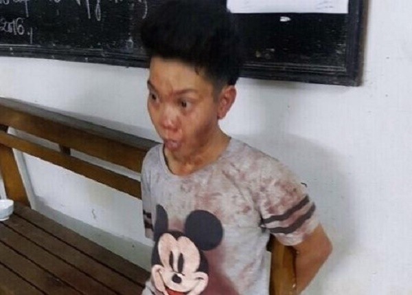 Ghen tuông với mối tình đồng tính, cô gái đâm chết nam thanh niên