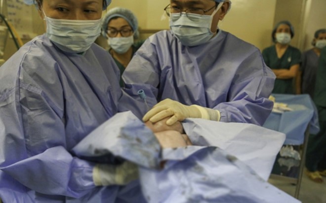 Các bác sĩ đã cứu sống bệnh nhi thành công nhờ áp dụng kỹ thuật EXIT. Ảnh: Sở Y tế TP.HCM.