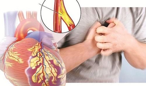 Tăng nguy cơ mắc bệnh gan về già khi thời trẻ béo phì 