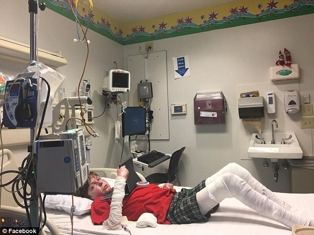 EB là bệnh hiếm gặp, với tỷ lệ mắc bệnh là 1/50.000 người. Ảnh: Facebook. Chân. 