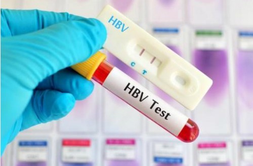 Phần lớn bệnh nhân ung thư gan tại Việt Nam từng nhiễm virus viêm gan B. Ảnh minh họa: dreamstime